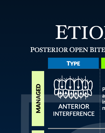 AACA Etiology of Posterior Open Bite Poster