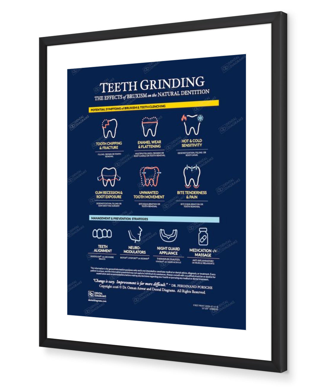 Teeth Grinding (Patient Education) 16" x 20" Poster