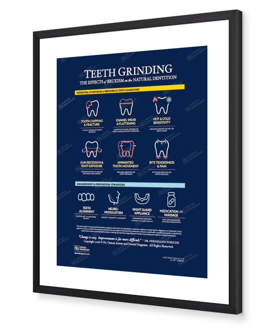 Teeth Grinding (Patient Education) 16" x 20" Poster