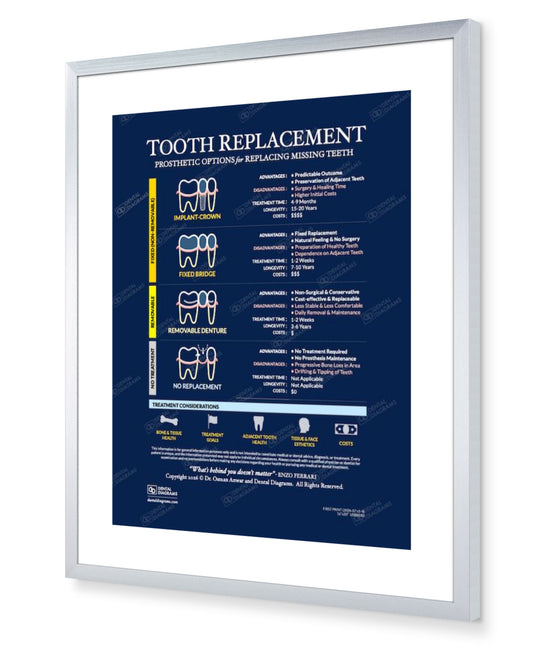 Tooth Replacement (Patient Education) 16" x 20" Poster
